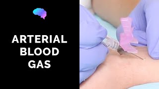 How to take an arterial blood gas ABG  OSCE guide  UKMLA  CPSA  PLAB 2 [upl. by Eiramesor]