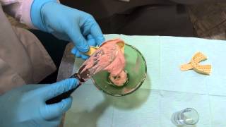 Taking an Awesome Alginate Impression [upl. by Anelaj]