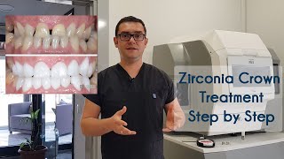 Zirconia Crown Treatment in Turkey amp How We Produce Zirconia Crowns in Elit Dental Clinic Kusadasi [upl. by Acemahs734]