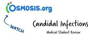 Candidal Infections Osmosis Study Video [upl. by Ainival729]