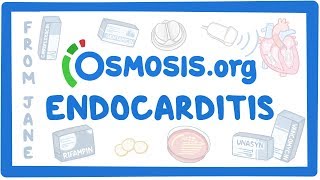 Clinicians Corner Endocarditis [upl. by Timus]