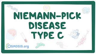 NiemannPick disease Types A and B  causes symptoms diagnosis treatment pathology [upl. by Yrffej317]