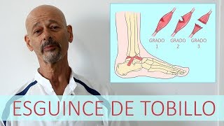 ESGUINCE DE TOBILLO  Lesión de ligamentos [upl. by Nightingale179]