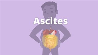 Ascites  Definition Causes Pathophysiology Diagnosis Management SAAG  Abdominal Distension [upl. by Leona]