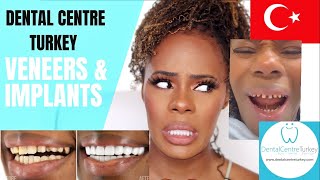 I HAD MY TEETH DONE IN TURKEY PART 1  DENTAL CENTRE TURKEY  Hollywood Smile Makeover  Veneers [upl. by Joslyn]