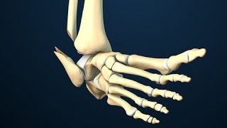 Ankle Fracture Surgery [upl. by Aryam]