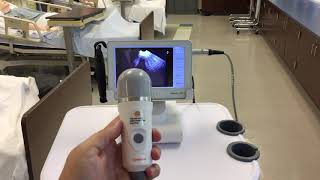 Caresono Bladder Scanner HowTo [upl. by Whit760]