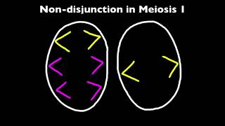 33 Nondisjunction and Down Syndrome [upl. by Mailliw]