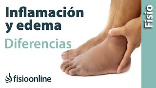 Inflamación y edema  Diferencias y características [upl. by Nina]