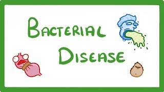 GCSE Biology  What Are Bacterial Diseases  Treatment and Prevention 37 [upl. by Meijer]