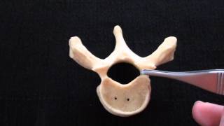 Typical Vertebra  Spinal column  Anatomy [upl. by Jemena934]