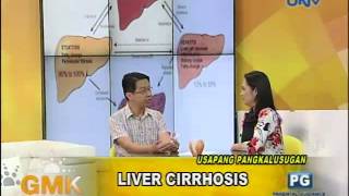 Understanding Liver Cirrhosis [upl. by Retsek861]