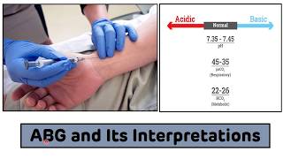 Arterial Blood Gas ABG Analysis  Arterial Blood Gas ABG Interpretations In 3 Easy Steps [upl. by Amhsirak]