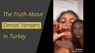 The Truth about Dental Veneers in Turkey [upl. by Kraft92]