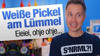 Kleine weiße Pickel am Penis  jungsfragende [upl. by Anaiuq]