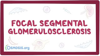 Focal Segmental Glomerulosclerosis  causes symptoms diagnosis treatment pathology [upl. by Elexa231]