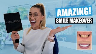 Smile Makeover Review All on 6 Dental Implants  Veneers Turkey [upl. by Aciamaj595]