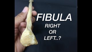 FIBULA  SIDE DETERMINATION [upl. by Sulamith]